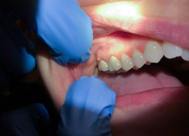 Best Mobile Emergency Dentist in Pond Creek, OK