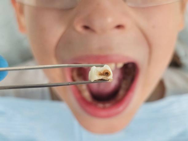 Best Emergency Dentist for Knocked-Out Tooth in Pond Creek, OK