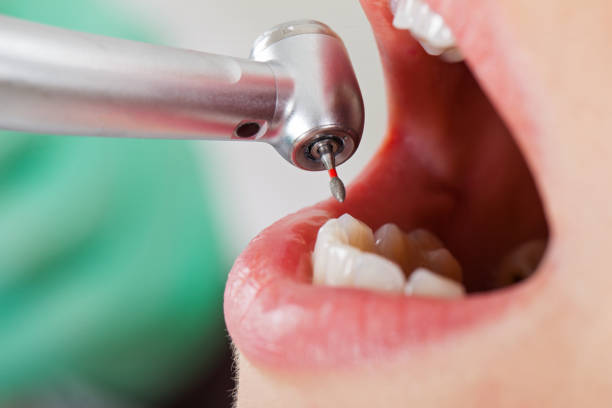 Best Emergency Root Canal Treatment in Pond Creek, OK